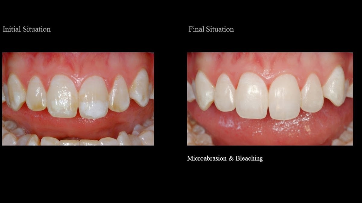 Helvetic Dental Center - Dr Nacer Benbachir - Dr Malika Meyer gallery image 8