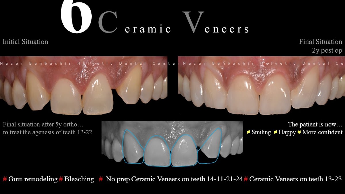 Helvetic Dental Center - Dr Nacer Benbachir - Dr Malika Meyer gallery image 9
