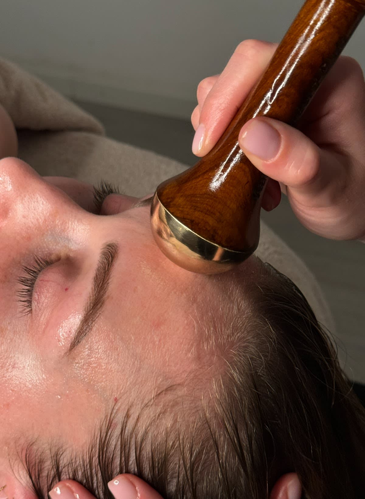 Luna Aesthetic gallery image 6