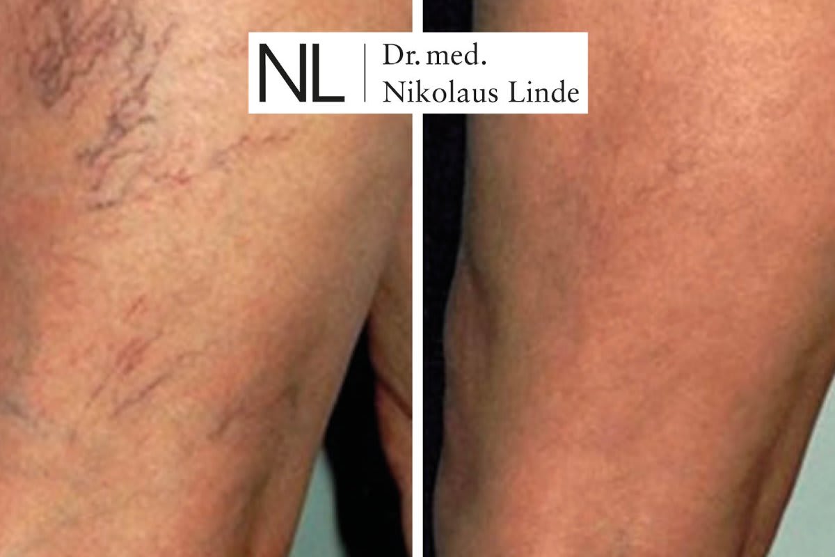 VENENCLINIC St. Gallen gallery image 1