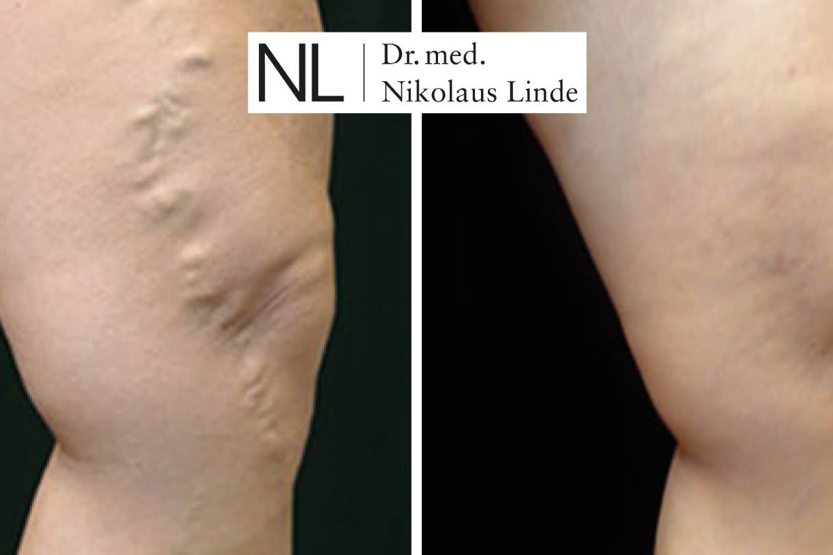 VENENCLINIC St. Gallen gallery image 2