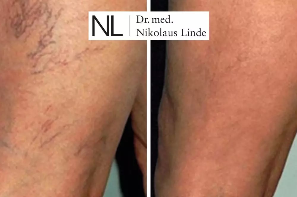 VENENCLINIC St. Gallen gallery image 4