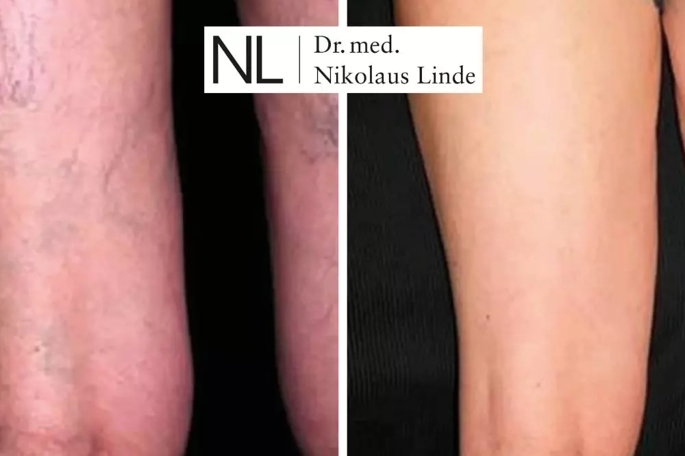 VENENCLINIC St. Gallen gallery image 5