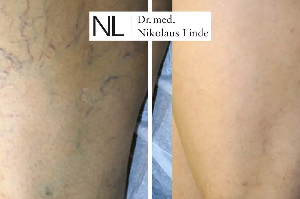 VENENCLINIC St. Gallen gallery image 6