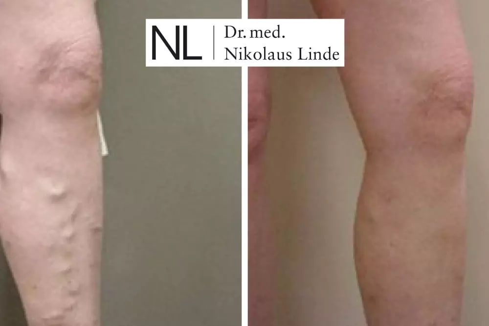 VENENCLINIC St. Gallen gallery image 7