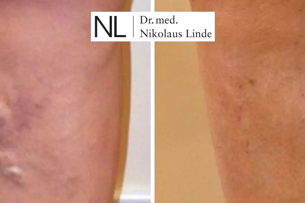 VENENCLINIC St. Gallen gallery image 8