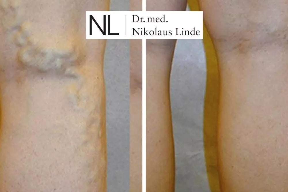 VENENCLINIC St. Gallen gallery image 10