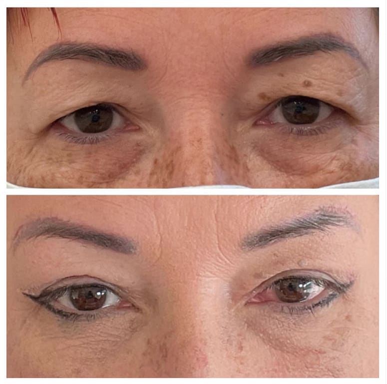 Dr med. Luca Ballestra - chirurgia e medicina estetica gallery image 10