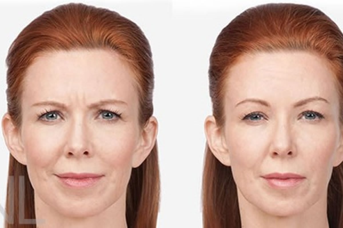 Dr. med. Nikolaus Linde | Schönheitsklinik Zürich gallery image 1