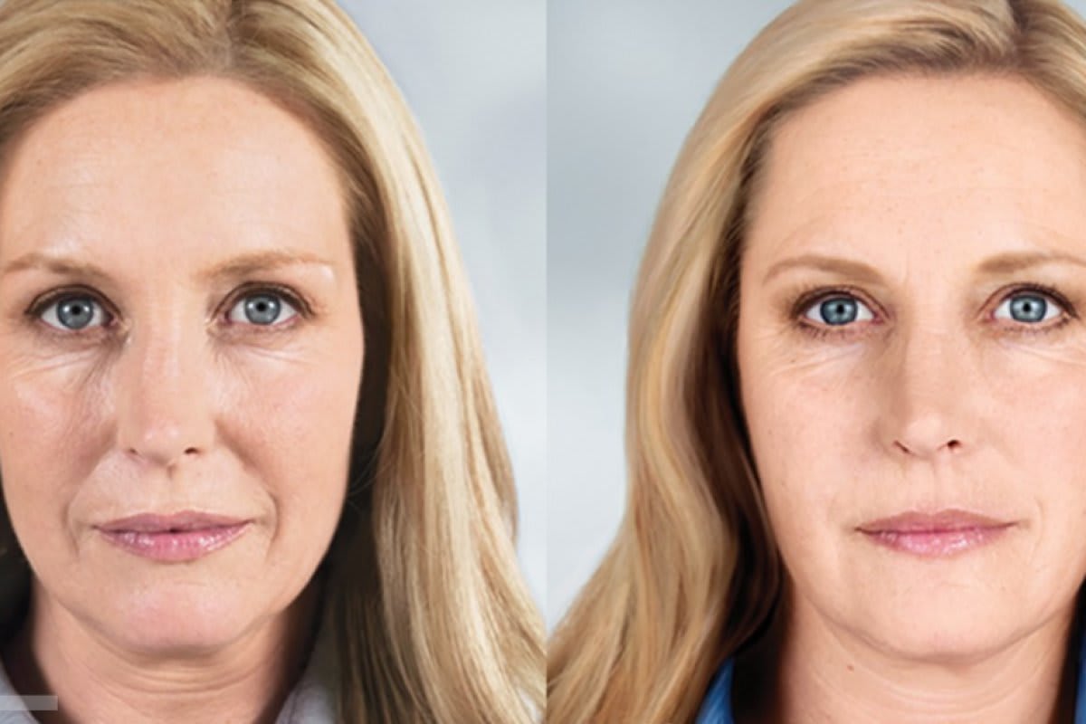 Dr. med. Nikolaus Linde | Schönheitsklinik Zürich gallery image 3