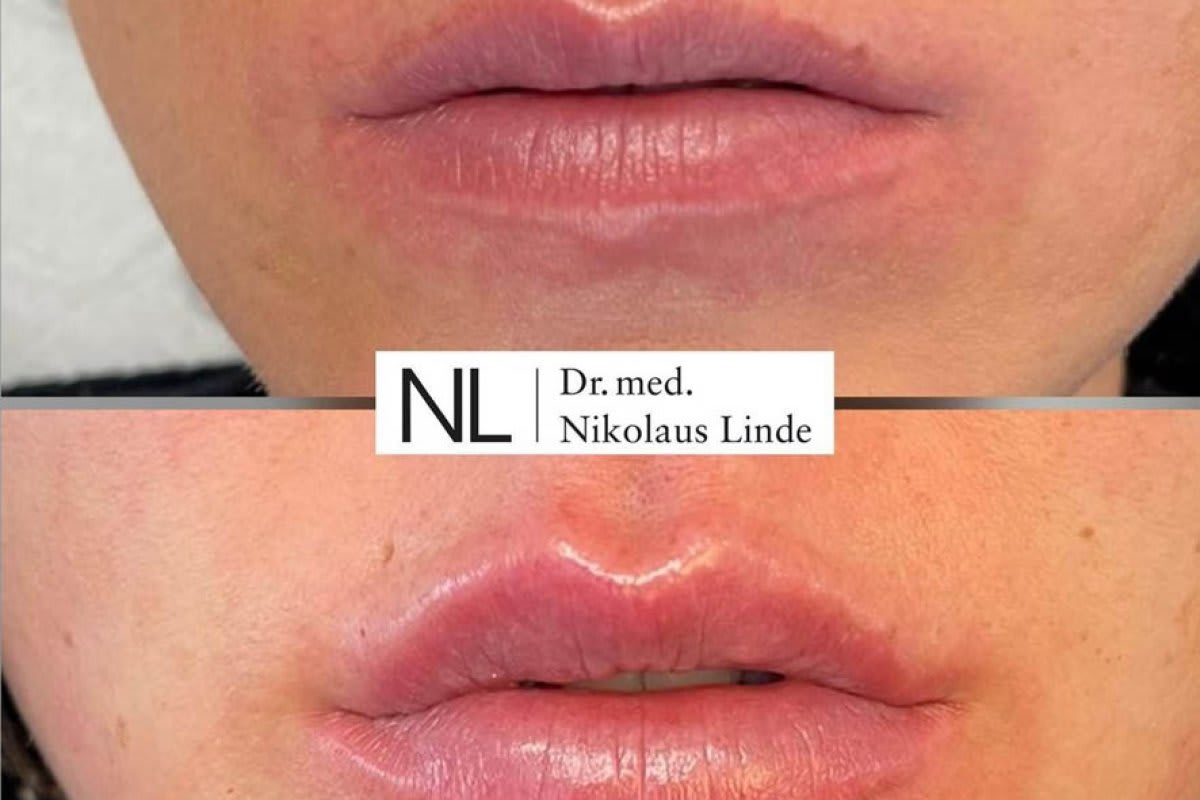Dr. med. Nikolaus Linde | Schönheitsklinik Zürich gallery image 8