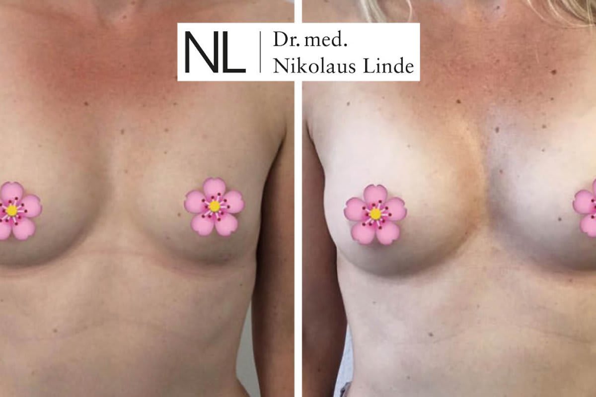 Dr. med. Nikolaus Linde | Schönheitsklinik Zürich gallery image 10