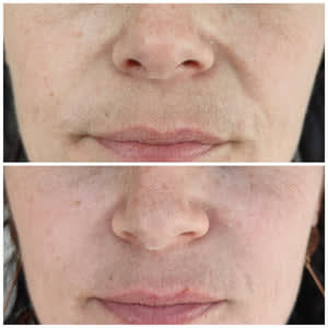 Belle sans filtre gallery image 1