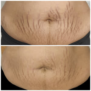 Belle sans filtre gallery image 2