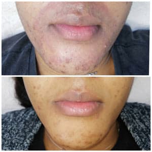 Belle sans filtre gallery image 4