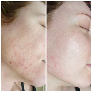 Belle sans filtre gallery image 5