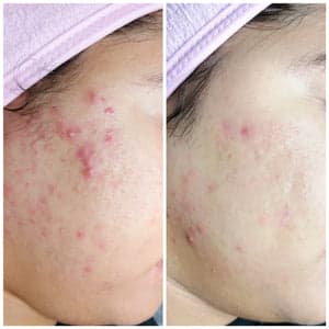 Belle sans filtre gallery image 6