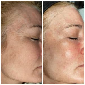 Belle sans filtre gallery image 9