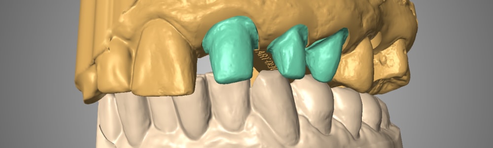 Art-Dent AG gallery image 4