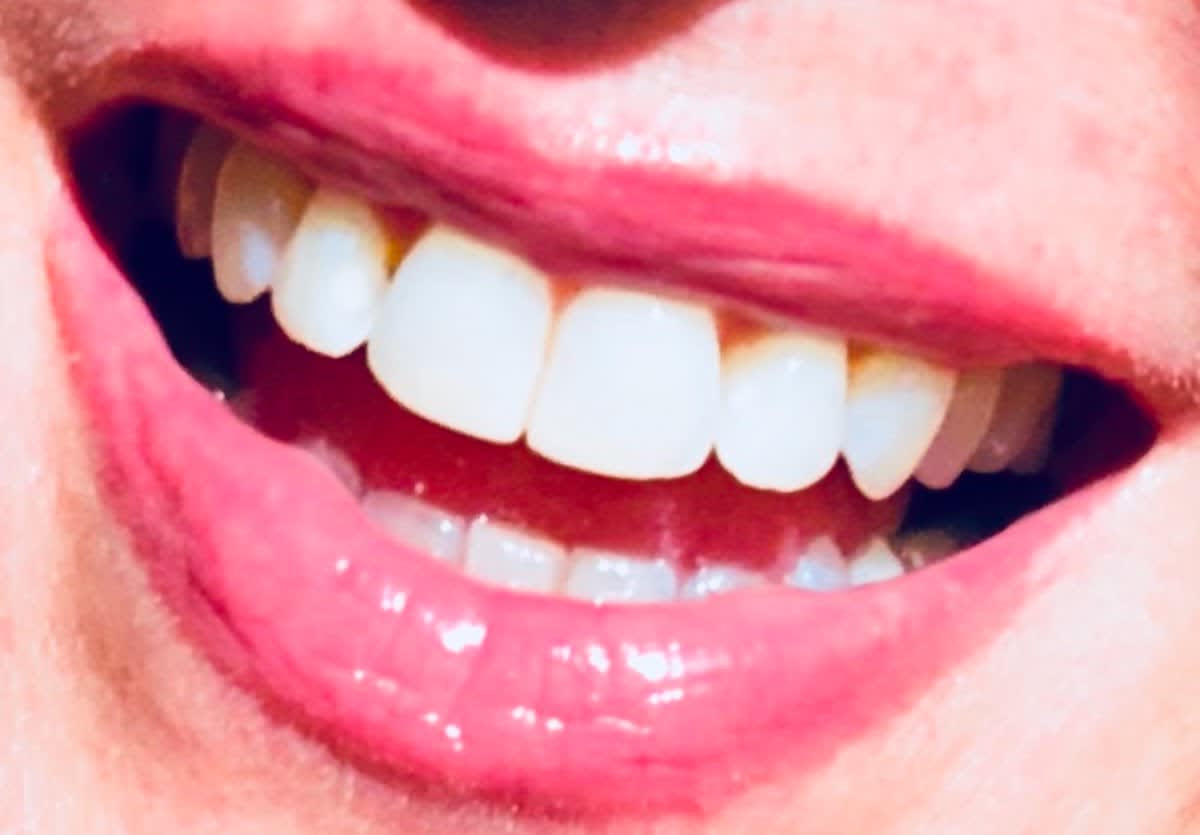 Zuger Zahnarzt - Praxis Dr. med. dent. Alexander Hölzle gallery image 2