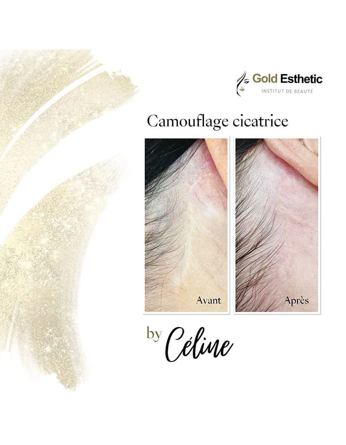 GoldEsthestic gallery image 4