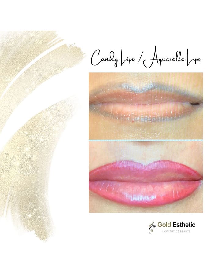 GoldEsthestic gallery image 6