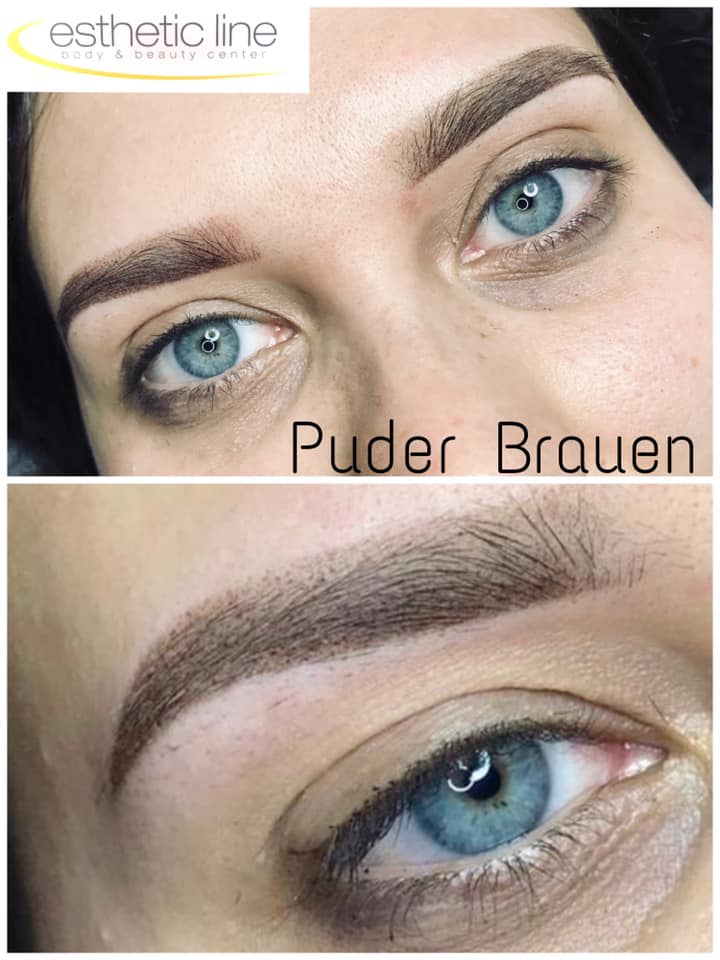 Esthetic Line – body & beauty center gallery image 7