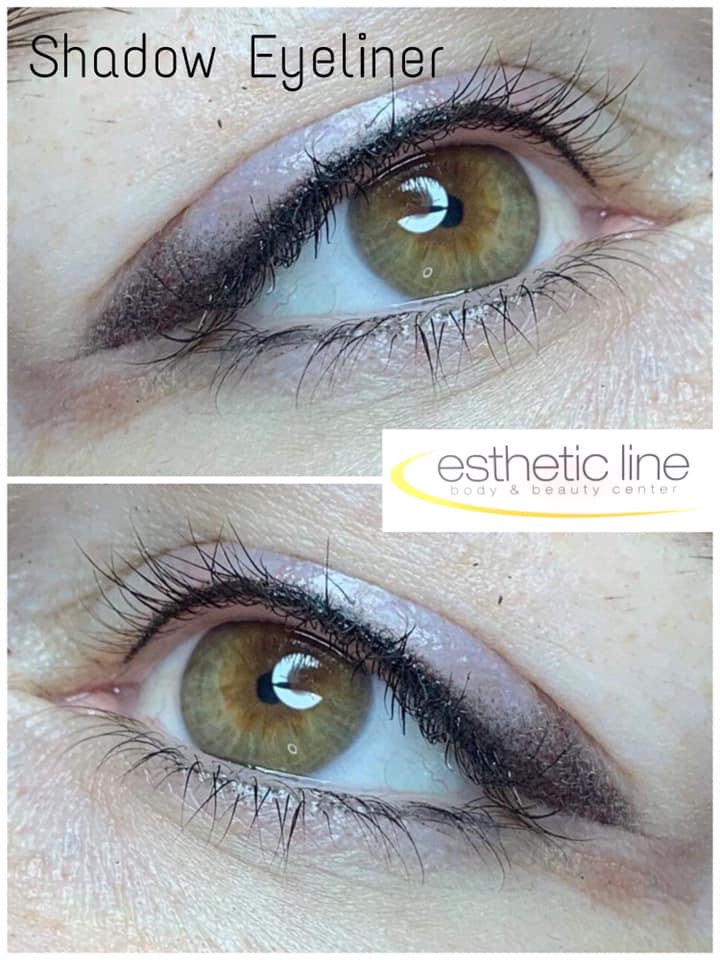 Esthetic Line – body & beauty center gallery image 9