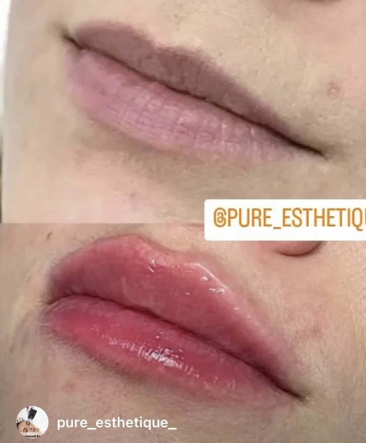 Pure Beauté Esthétique gallery image 5