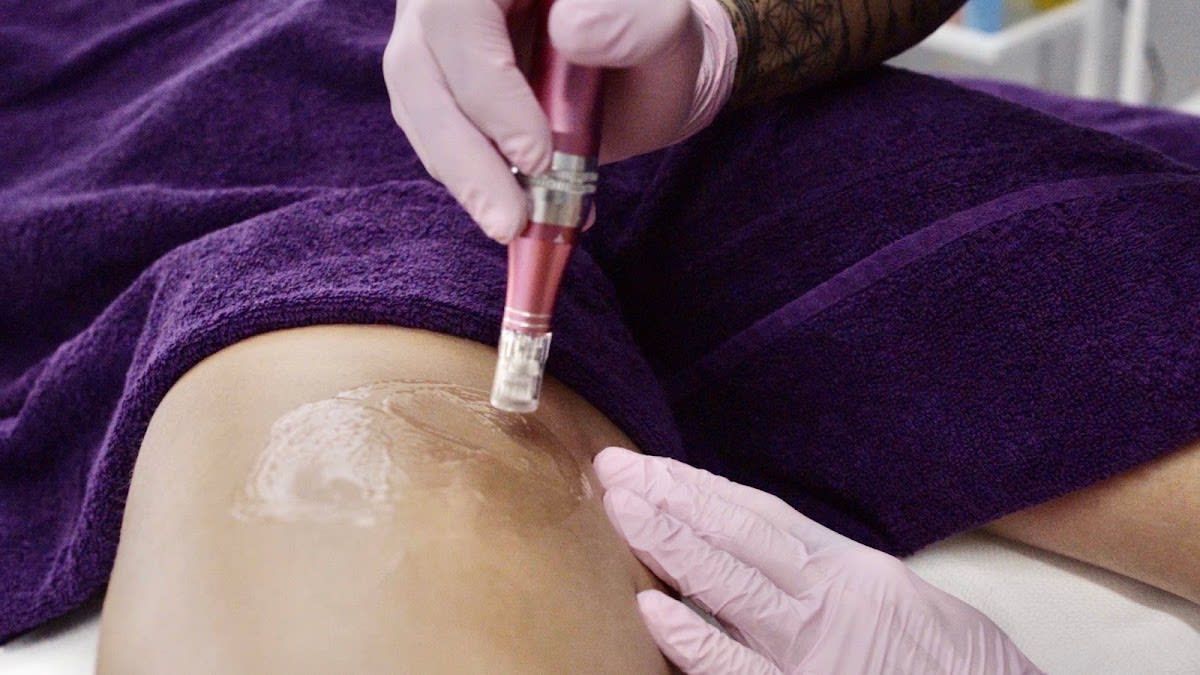 CosMedx Valeria Sterlacci gallery image 9