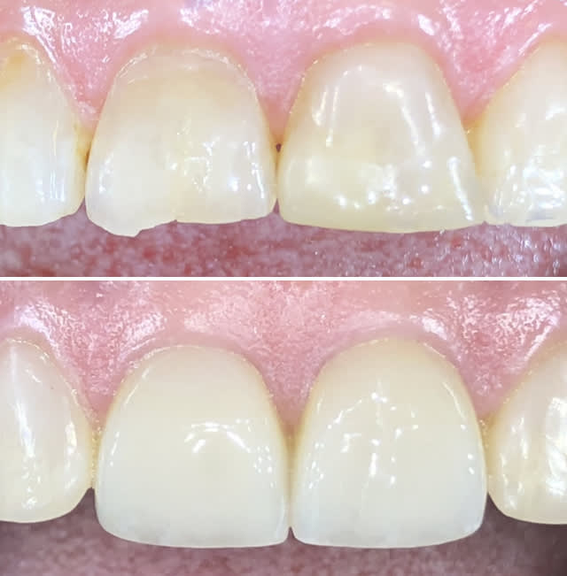 Zahnarztpraxis Dr. med. dent. Kamila Iwanski Luzern gallery image 3