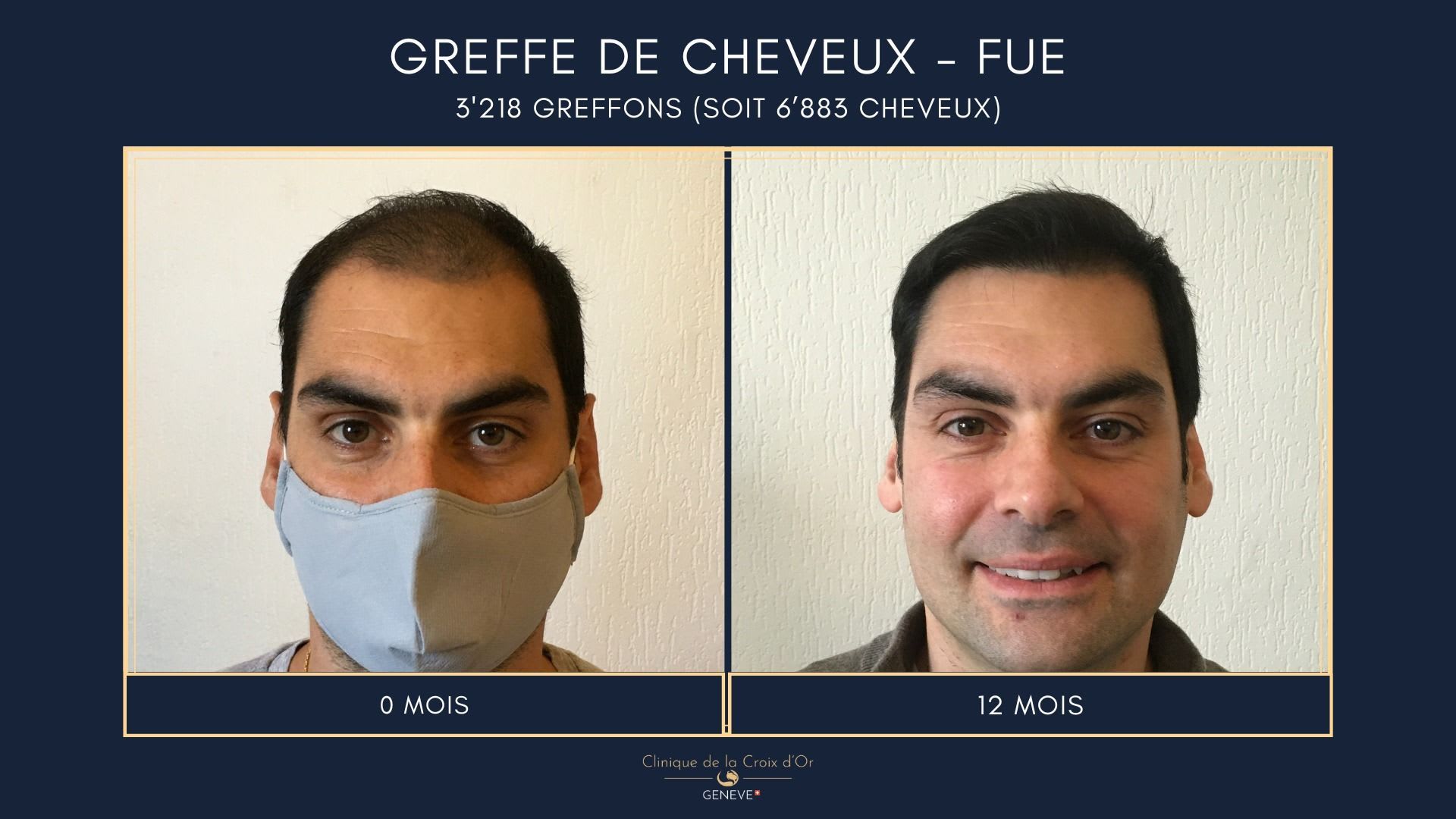 Clinique du Cheveu gallery image 1