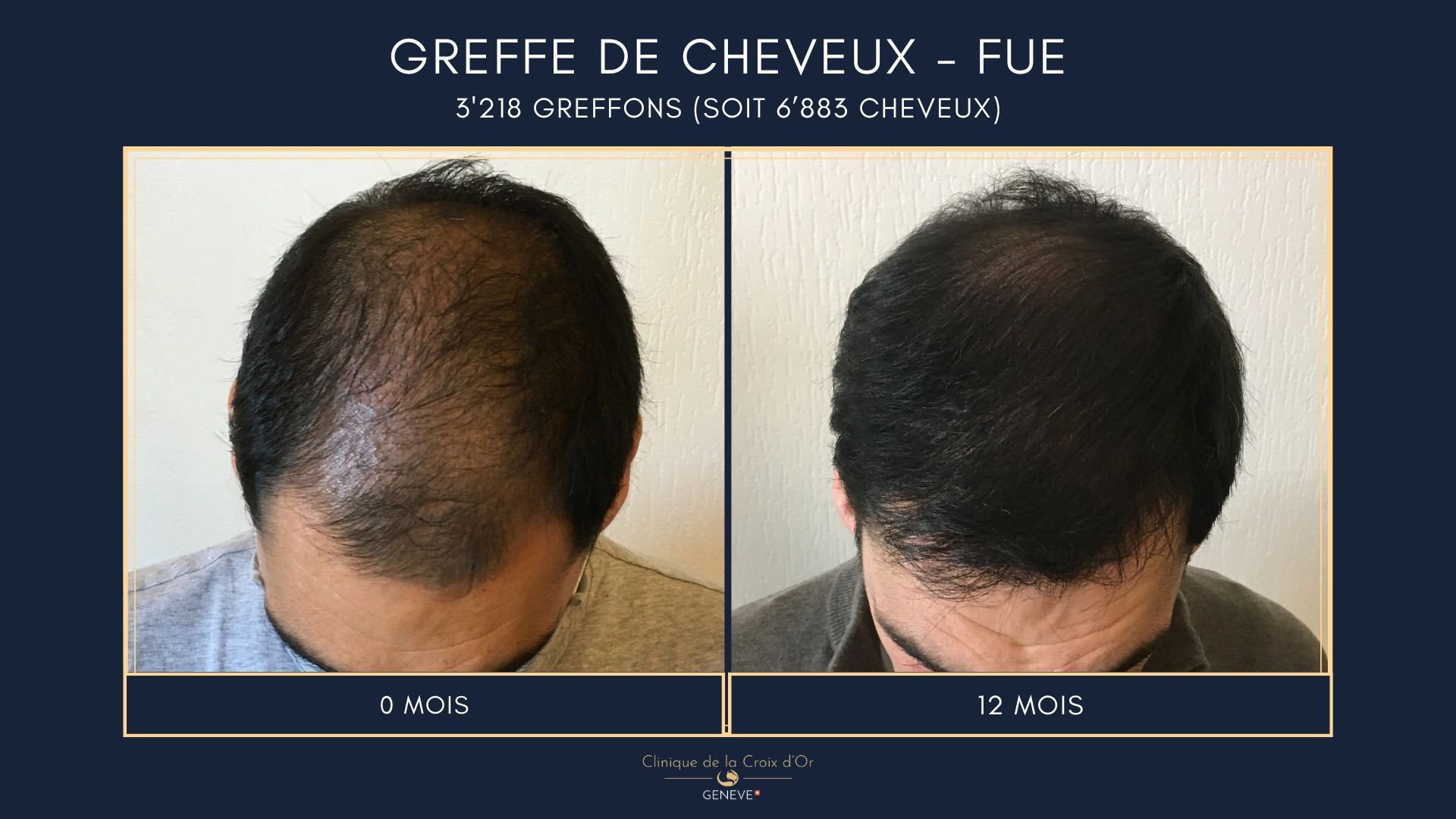 Clinique du Cheveu gallery image 2