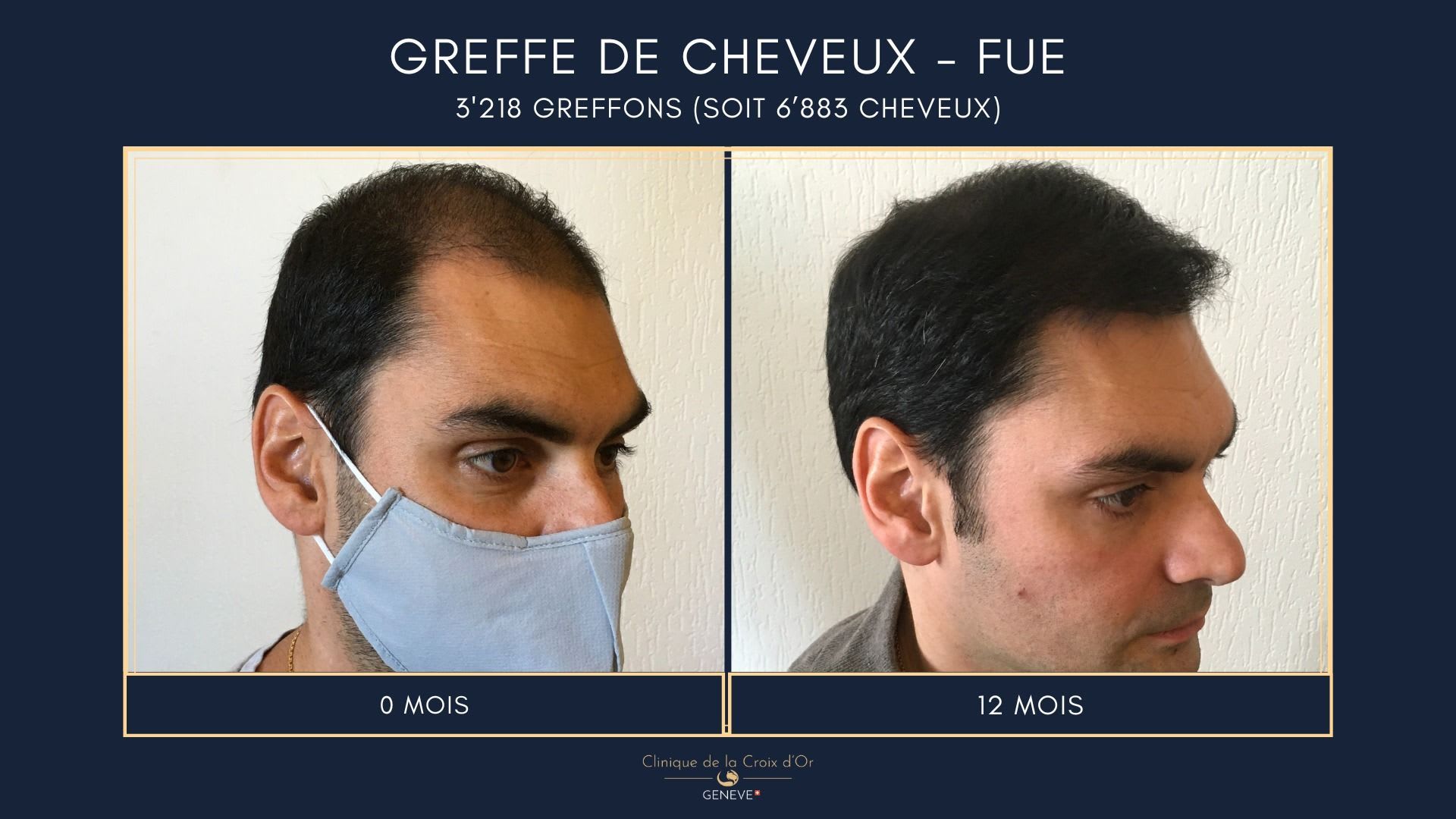 Clinique du Cheveu gallery image 3