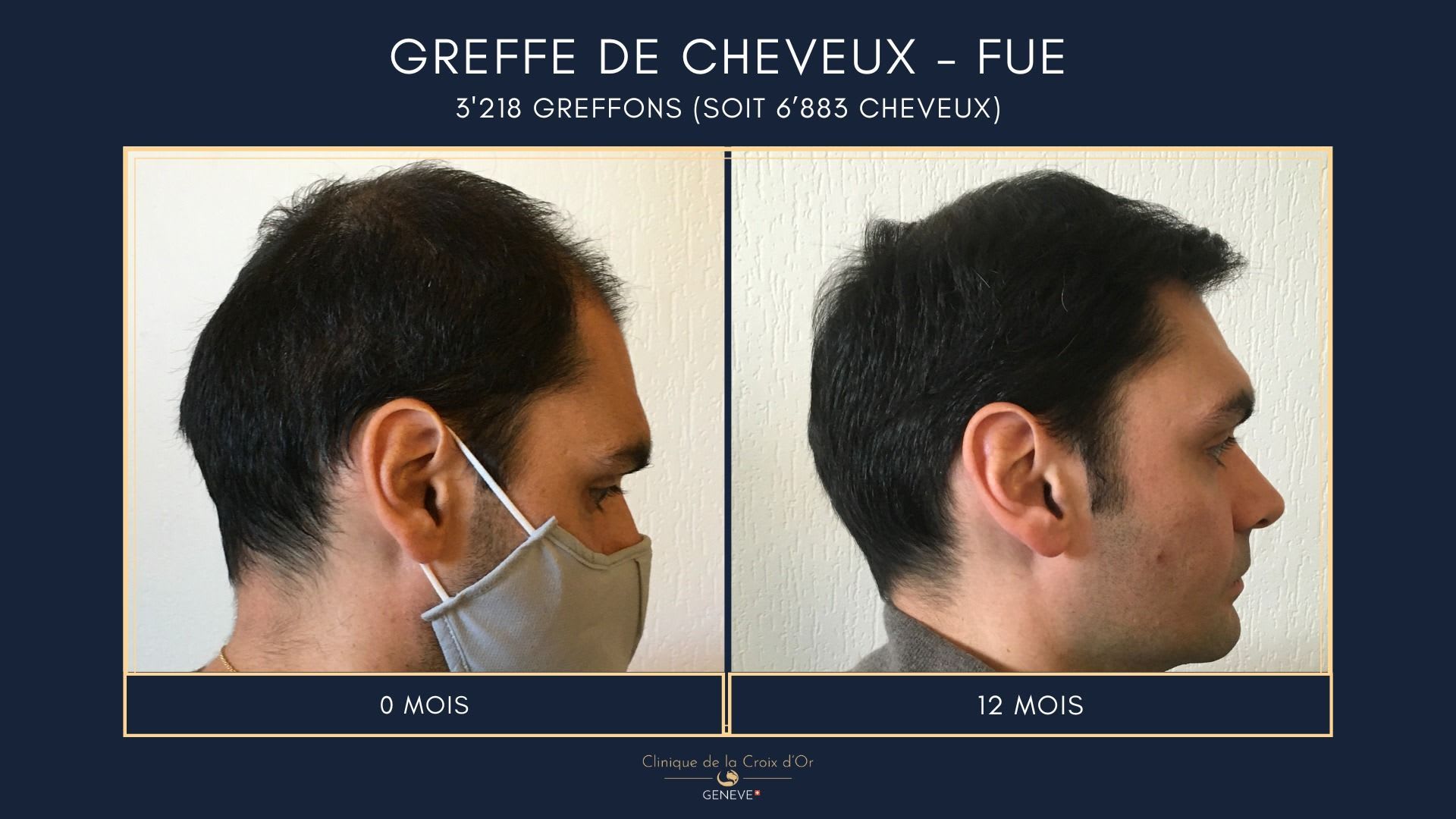 Clinique du Cheveu gallery image 4