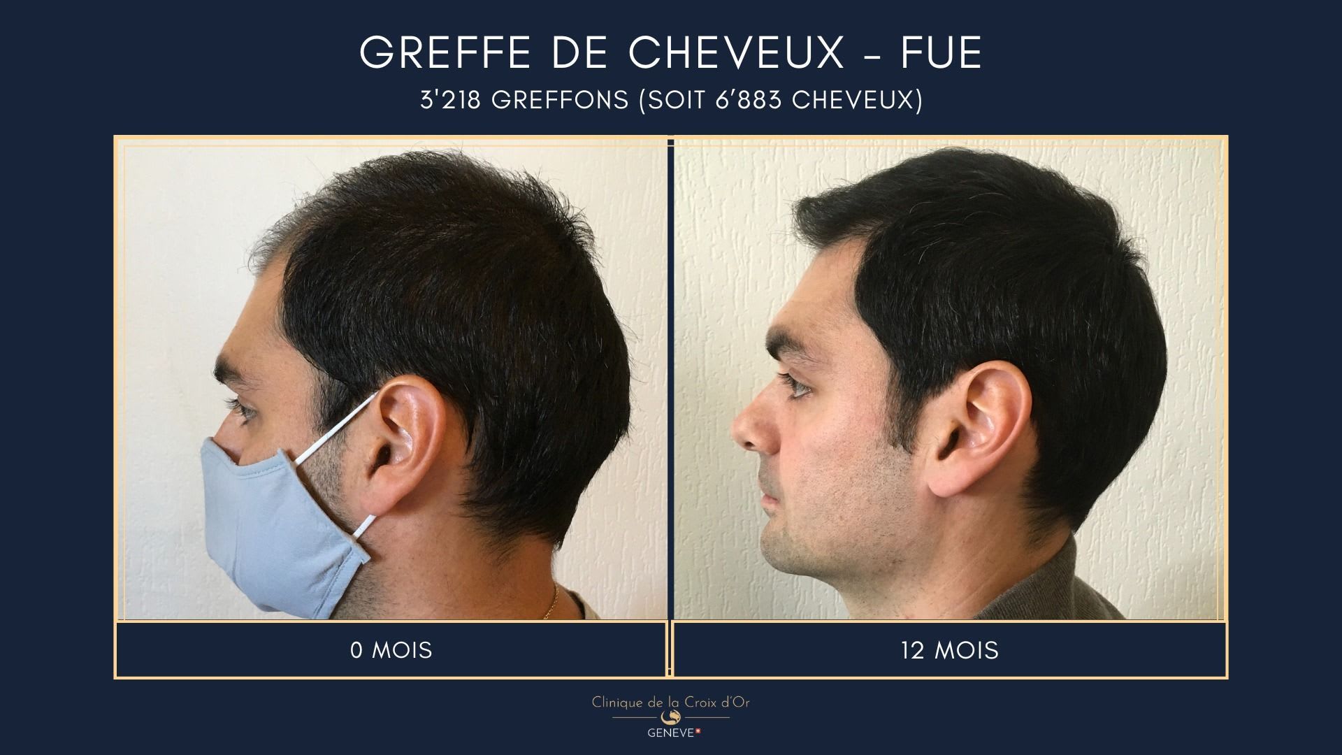 Clinique du Cheveu gallery image 5