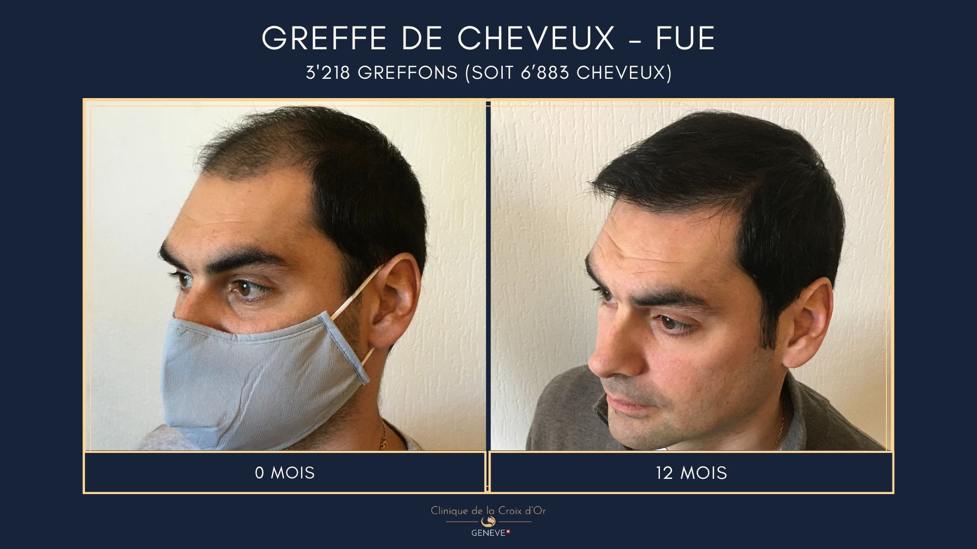 Clinique du Cheveu gallery image 6