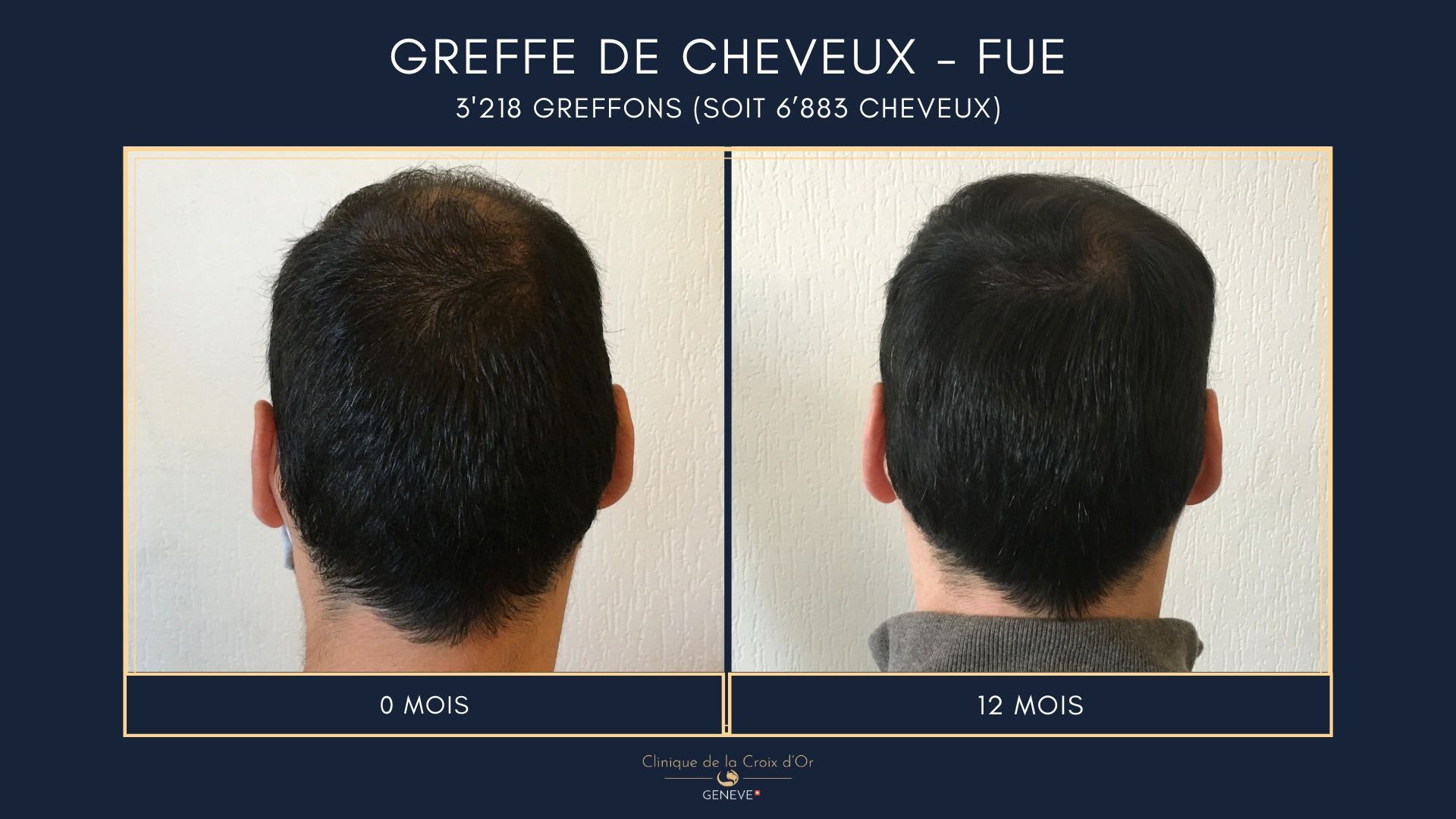 Clinique du Cheveu gallery image 8