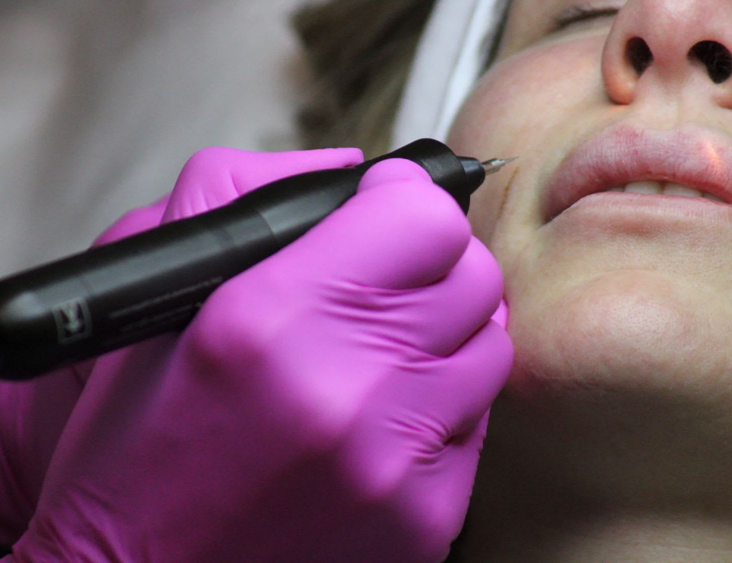 Art Visage - Estetica Medicale Lugano Centro gallery image 7