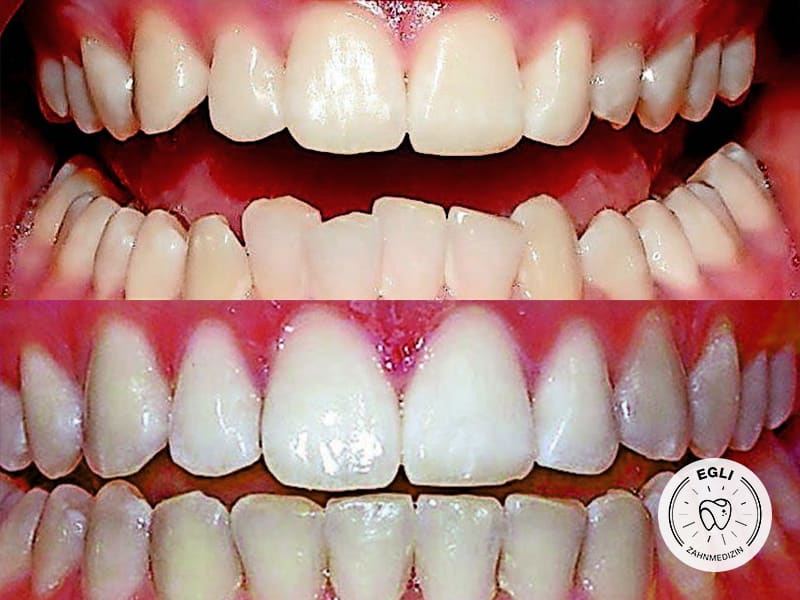 Egli Zahnmedizin - Zahnarzt, Kieferorthopäde & Oralchirurg in St. Gallen gallery image 5