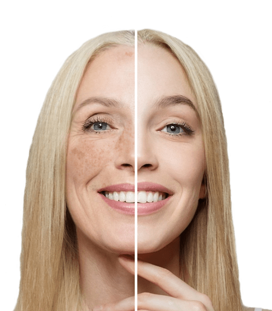 CLINIK Genève Tour Balexert | Spécialiste en Épilation Laser et Rajeunissement Laser gallery image 1