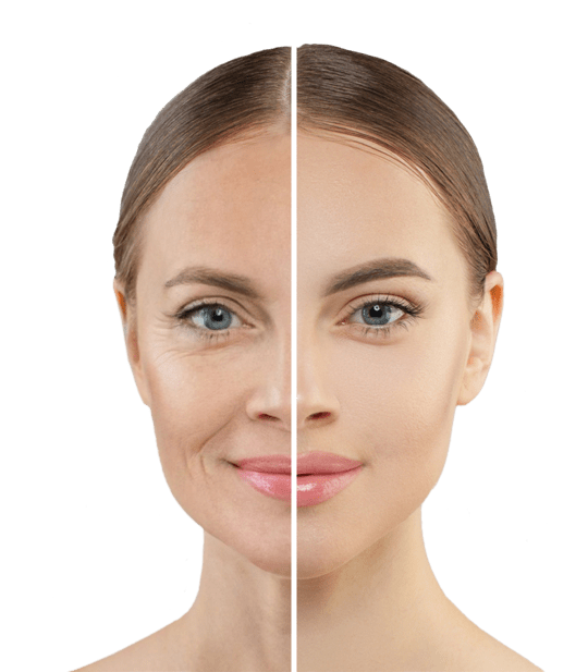 CLINIK Genève Tour Balexert | Spécialiste en Épilation Laser et Rajeunissement Laser gallery image 3