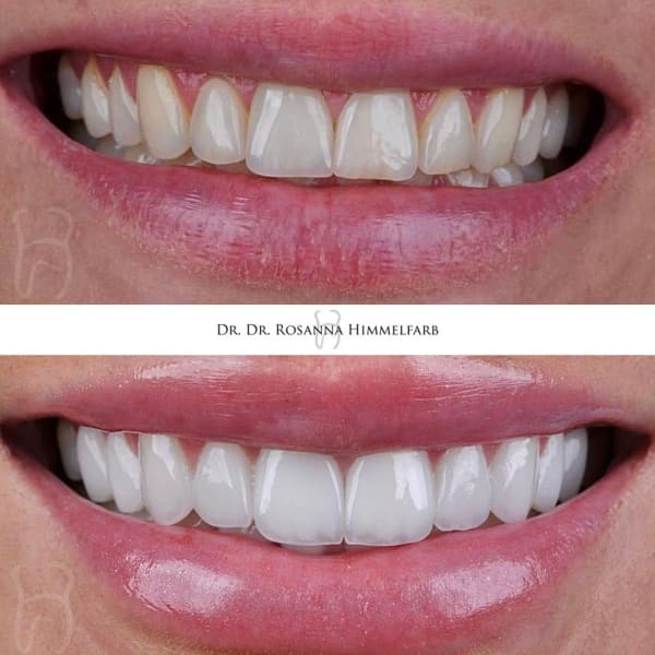 Dental Clinic Lucerne - Emergency Dentist Lucerne gallery image 2