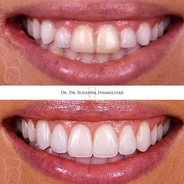 Dental Clinic Lucerne - Emergency Dentist Lucerne gallery image 3