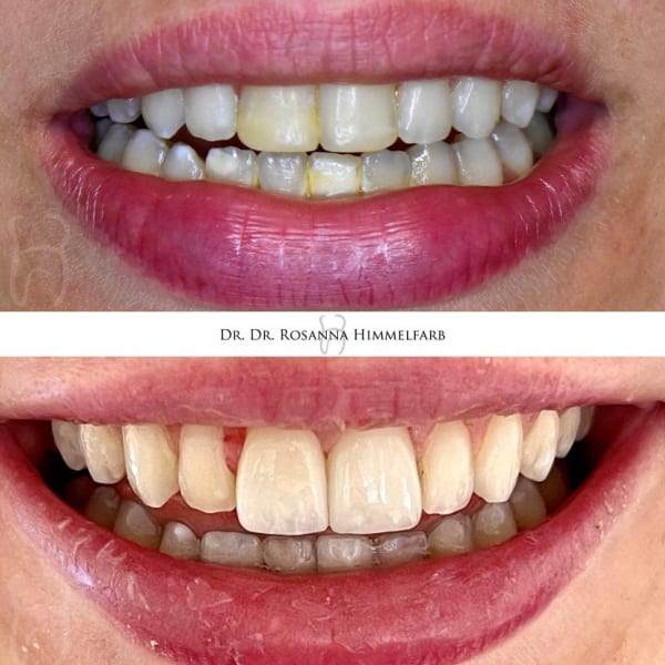 Dental Clinic Lucerne - Emergency Dentist Lucerne gallery image 4