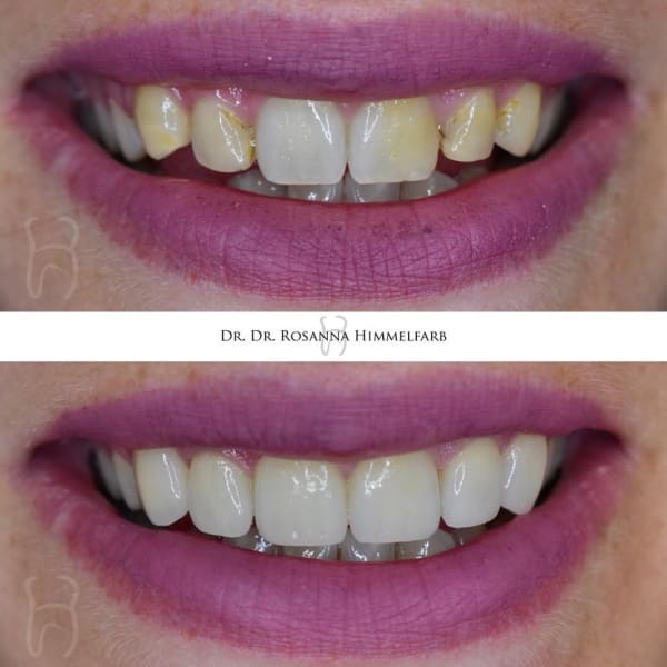 Dental Clinic Lucerne - Emergency Dentist Lucerne gallery image 5