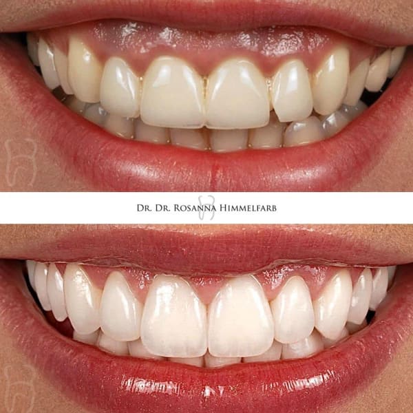 Dental Clinic Lucerne - Emergency Dentist Lucerne gallery image 6