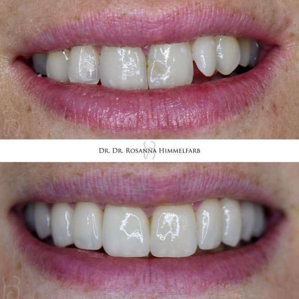 Dental Clinic Lucerne - Emergency Dentist Lucerne gallery image 7