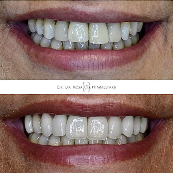 Dental Clinic Lucerne - Emergency Dentist Lucerne gallery image 8