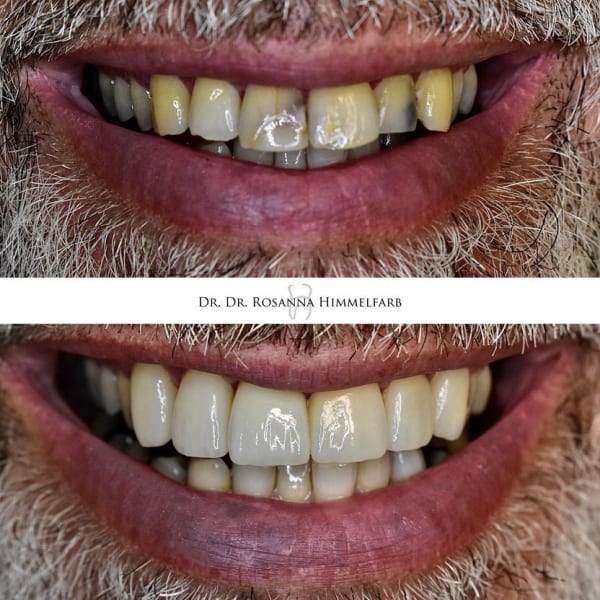 Dental Clinic Lucerne - Emergency Dentist Lucerne gallery image 9